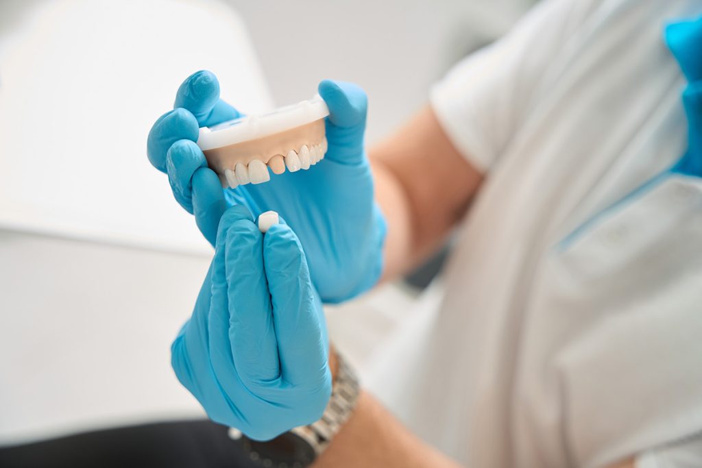 Same Day Crown Designing Smiles Mn